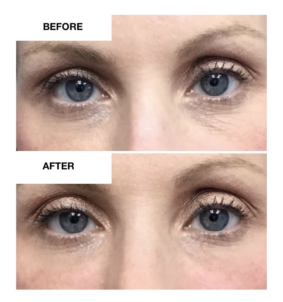 PRF Therapy Pahrump