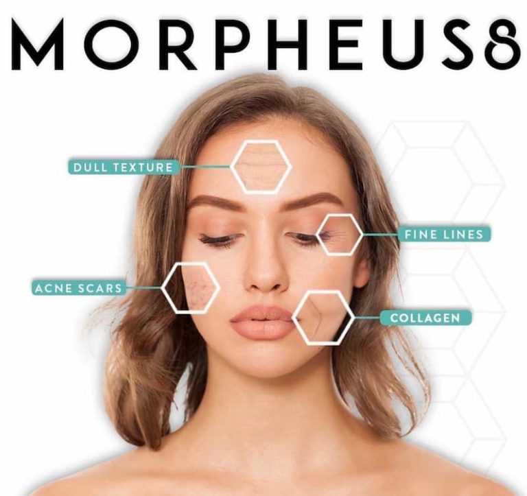 Morpheus Treatments