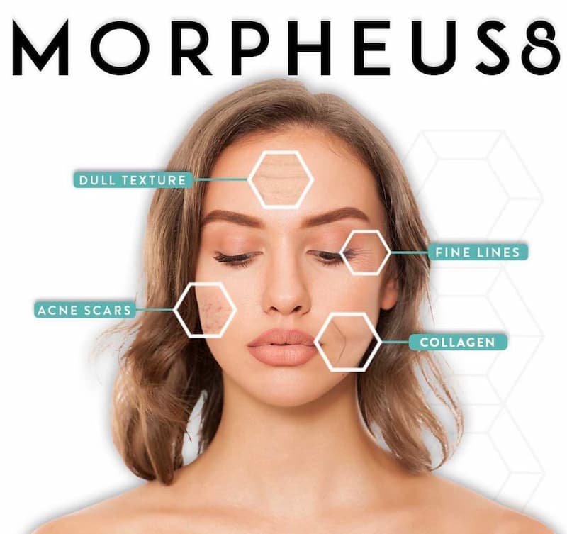 Morpheus Treatments