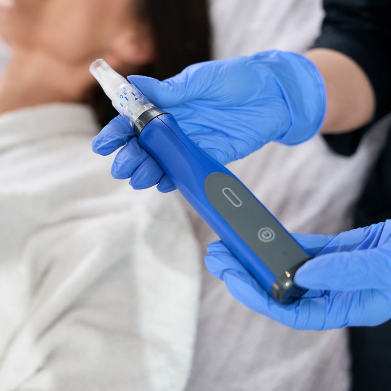 Benefits of SkinPen Microneedling