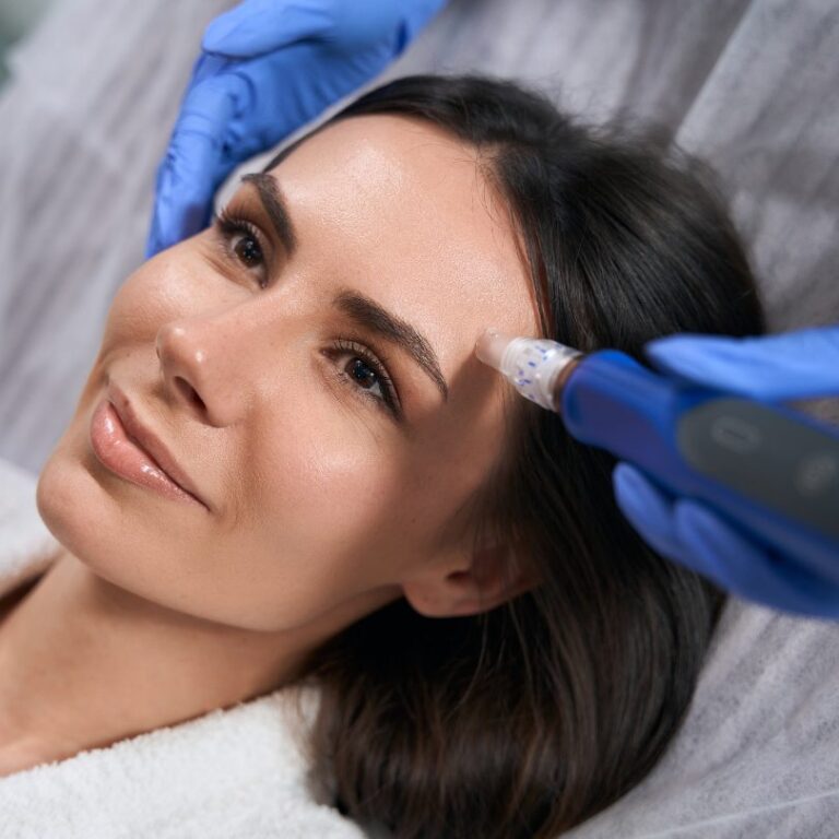 What is SkinPen Microneedling