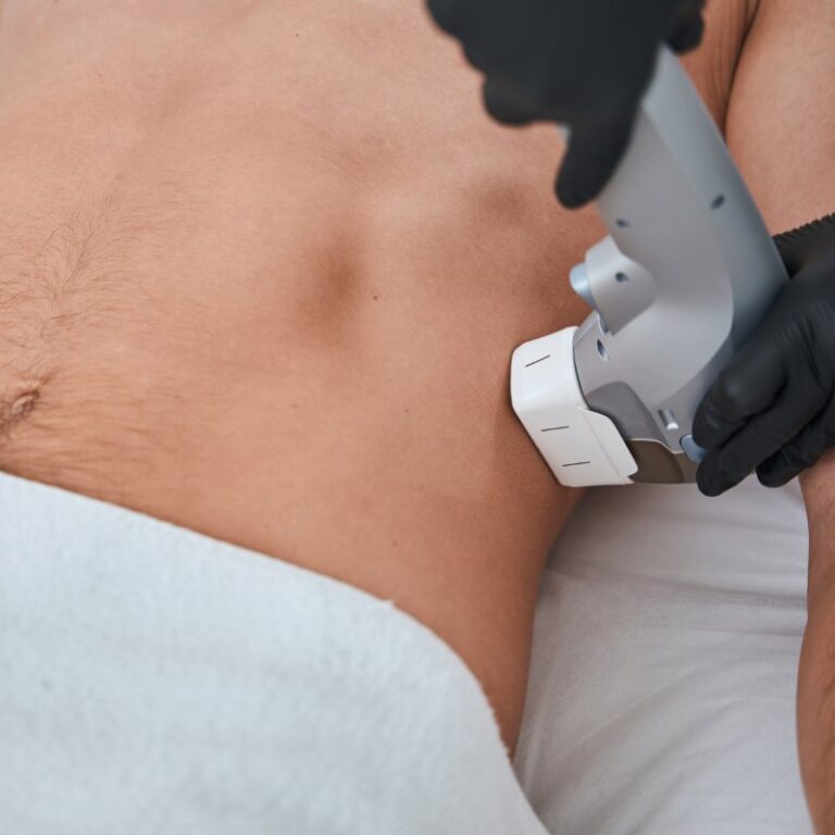 summer body prep with non-invasive treatments