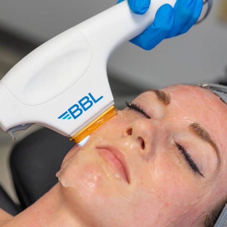 BBL treatment in Pahrump NV